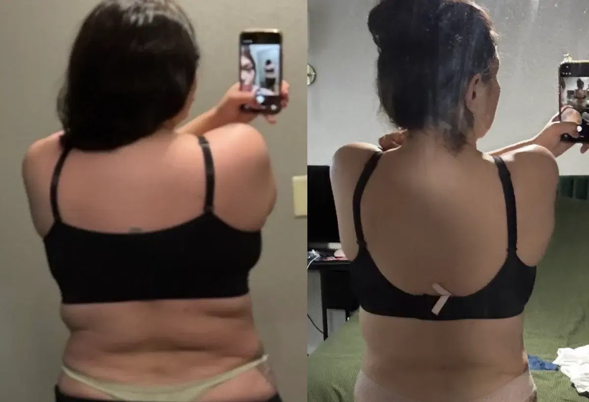 Olivia C. before treatment