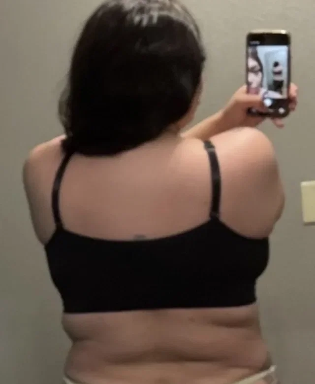 Olivia C. before treatment