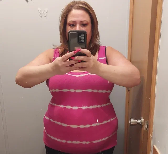 Robyn W. before treatment