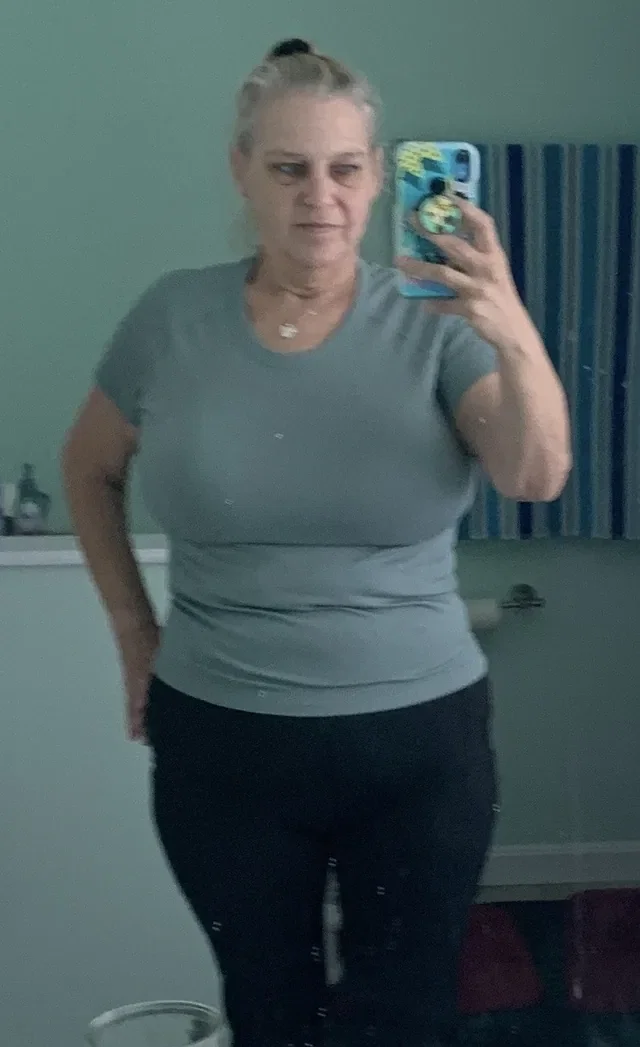 Victoria W. before treatment